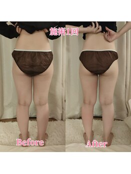 ヨサパーク サーナ 仙川(YOSA PARK Sana)/20代お客様ビフォー⇒アフター