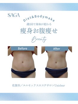 ユニクリア(Uni clear)/佐賀市ユニクリア・痩身エステ