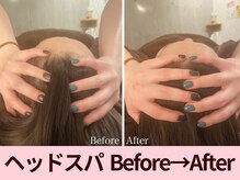 クイーンズチャーム(Queen's Charm)/大人気★パワーツリーヘッドスパ