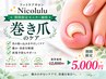 期間限定モニター【巻き爪補正!繰り返さない!】改善 12,800円→5,000円