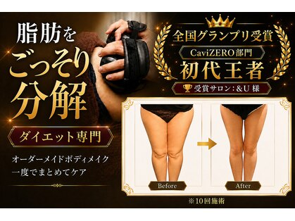 アンドユー(&U)の写真