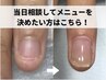 【深爪矯正or自爪育成】迷った方はこちらのクーポンをご選択ください*