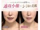 エクラ 六本木(eclat)の写真/【ほうれい線・たるみ・毛穴落ち】プラズマor高圧ニードルレス◇ほうれい線・たるみ悩み別選べる本格ケア