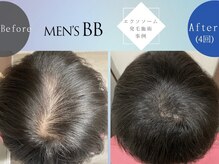 メンズビービー 福井高柳店(MEN'S BB)の雰囲気（希少なヒト幹細胞原エクソソーム原液100％で抜け毛、肌悩み改善）