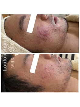 ルルボーテ(Loulou Beaute)/waxxxx+VOSサロンケア