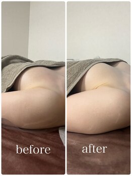 ムゲット/1回でバストアップ!