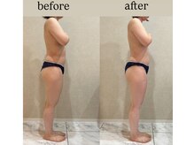 シェリーナ(cherieNa)/運動、食事なしでも変わる