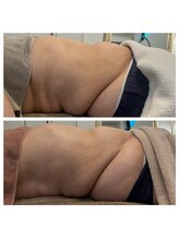 美温(mion)/背中のたるみも滑らかに