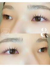 アネラ 仙台駅東口店(ANELA)/&Healthy100本