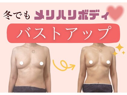 マリン(MARINE)の写真