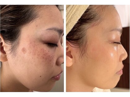 ラシェプリズ(LACHER PRISE)の写真