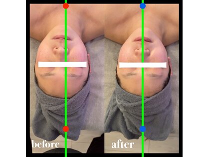 心と身体のbeauty salon Relier（ルリエ） 【小顔コルギ/よもぎ蒸し/フェムケア】の写真