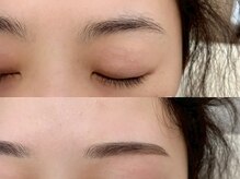 ホワイトアイ 心斎橋(WHITEEYE)/【眉毛/まゆげ】Before/After