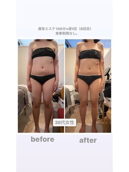 トランキーロ(Tranquilo)/むくみのせいで体重増の方へ