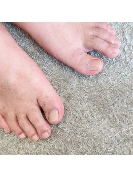 リンネ(Rinne)/フットケア