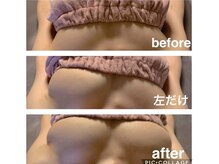 ラリノレア(LA RINOREA)の雰囲気（[平均2アップバストケア]衝撃のビフォーアフターはフォトへ♪）