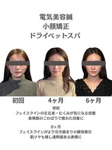 クリアランス(CLEARANCE)/施術回数6回 TAIGA