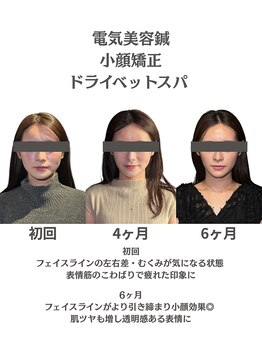 クリアランス(CLEARANCE)/施術回数6回 TAIGA