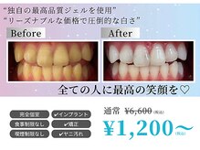 ホワイトニングショップ 和歌山店