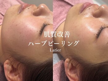 ラティエ(Latier)/ハーブピーリング