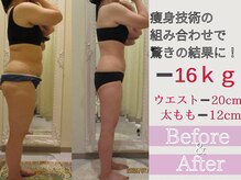 クリニカルエステ/イーズ パークプレイス大分店