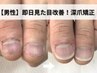 【男性専用】周囲にバレない、即日見た目改善深爪矯正