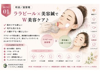 ハリナチュレ 町田店の写真/美容鍼＋ララピールで綺麗に小顔に！