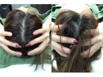 イーリス(iris)/頭蓋調整