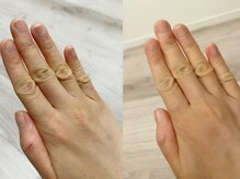 イチハチドット(18.)/手荒れにも♪