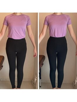 ザ エスアップ 博多店(THE S-UP)/施術前後写真