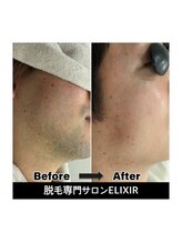 エリクサー 太田店(Elixir)/before after