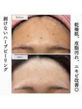 ラヴェンナサロン 札幌店(Ravenna salon)/カサカサ肌にさようなら～♪