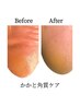 【8月キャンペーン】フットマグネット＋かかと集中ケア 12100→9830