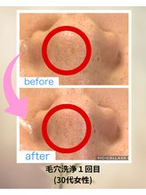 クローバー(clover)/白いニョキニョキ対策