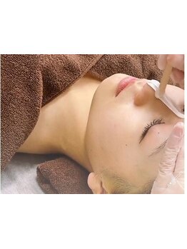 顔脱毛がしたい