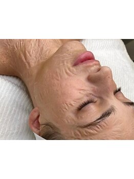 ハリツヤをUPしたい