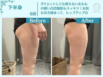 フローフシ∞/【痩身】下半身脂肪・むくみ撃退