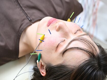 鍼灸院くろえ 大阪江坂の写真