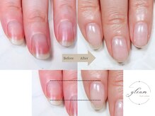 保育士さん医療系のネイル不可の方も多くご来店されてます