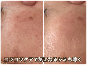 プライベートサロン サイ(sai)/お肌もコツコツが大切◎