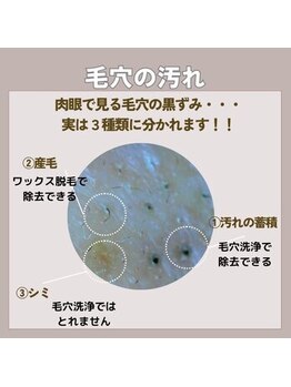 マヴィ 守口店(MavY.)/毛穴の汚れをスッキリ！