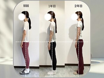 スュクシー ピラティススタジオ 日本橋店(Succy pilates studio)/２年継続クライアントの姿勢変化