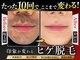 ツバキ(TSUBAKI)の写真