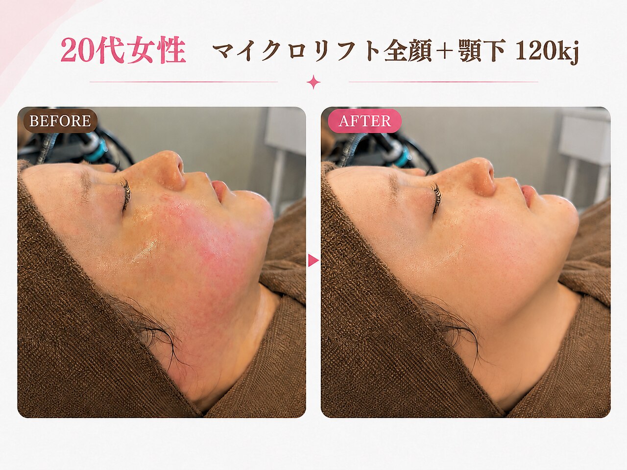 リフト 静岡(Lift)｜ホットペッパービューティー