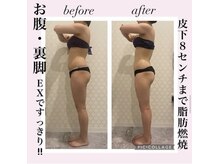 シャルム(CHARME)/インディバで健康的な体へ