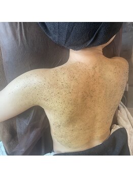 ダリア(Dahlia)/ハーブピーリング【背中】