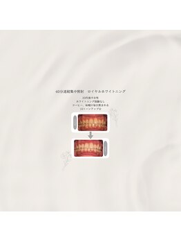 プラスビーセルフ(+b self)/ホワイトニングビフォーアフター