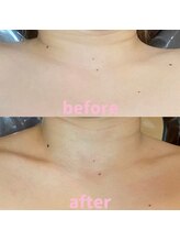 ビュール 銀座(BeauL)/