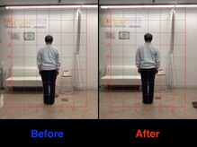 整体院 仁(JIN)/#仙腸関節#骨盤#骨盤の歪み#腰痛