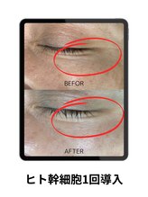 コンバートビューティーオタイ(ConBert Beauty otai)/シワ緩和・トーンUP